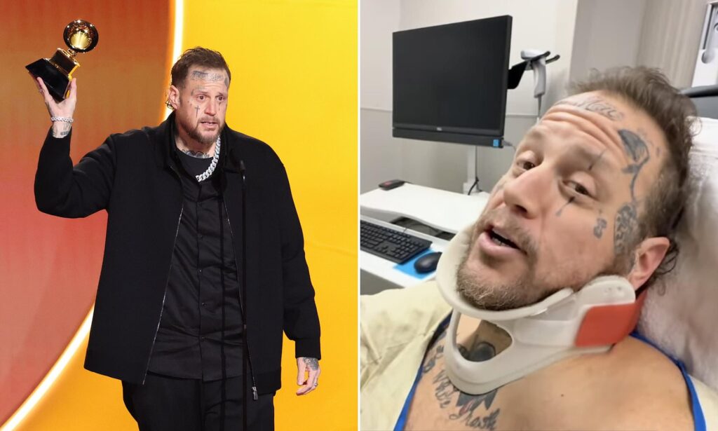 Jelly Roll reveals he attended 2026 Grammys with a broken collarbone after ATV accident